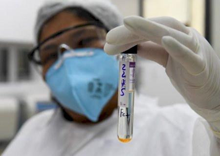 Sequenciamento genômico da turberculose será feito em MS
