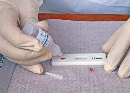 MS registra 330 casos de covid em sete dias