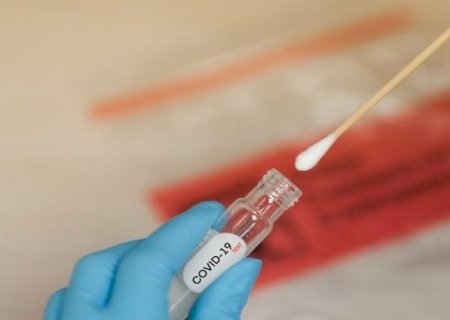 MS registra 349 casos e cinco mortes por Covid na semana