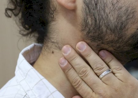 SES reforça prevenção e diagnóstico precoce do Câncer de Cabeça e Pescoço