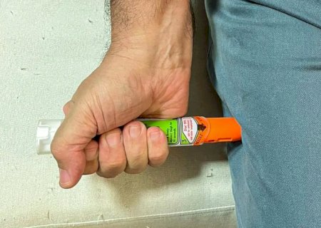 Alergia grave: pesquisadores criam 1ª caneta de adrenalina brasileira