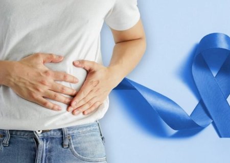 Especialista da SES alerta para câncer de intestino: rastreamento deve começar aos 45 anos
