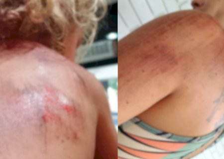 Corrida de aplicativo termina com mulher e criança feridas em MS