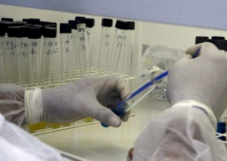 Lacen/MS recebe nota máxima em ensaios de proficiência e reforça excelência técnica