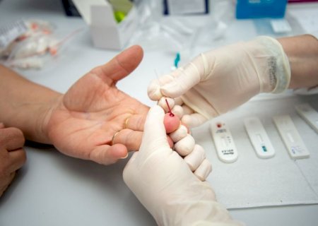 Prefeitura realiza mais de 2 mil testes e não registra novos casos de hepatite B em 2026